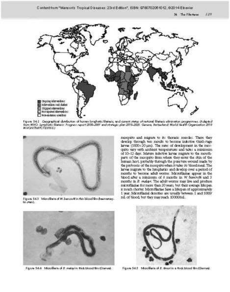 Manson S Tropical Diseases Expert Consult Online And Print Edition