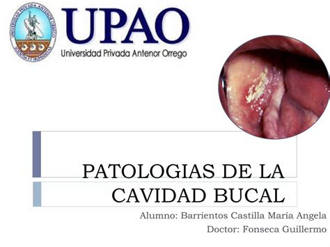 PDF Patologias De La Cavidad Bucal Dr Fonseca PDFSLIDE NET