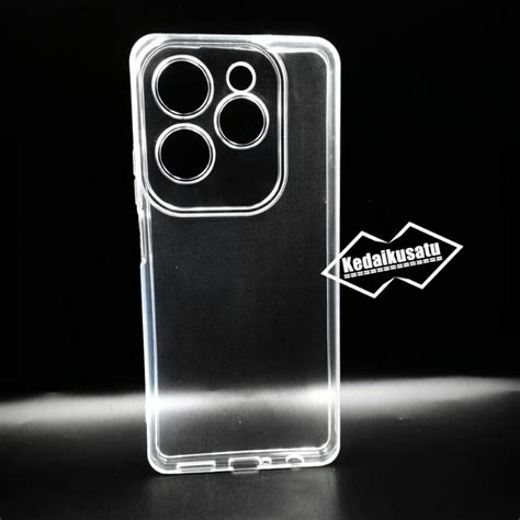 Infinix Hot Pro Clear Case Hd Softcase Clear Transparent Anti Fungal Shopee Singapore