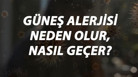 Güneş Alerjisi Nedir Neden Olur Ve Nasıl Geçer Güneş Alerjisi