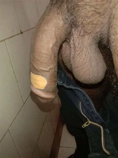 Streched Hurted Dick Nude Pics XHamster