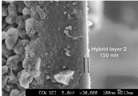 Figure From Synthesis Of Nanoporous Silica Membrane And Their Gas