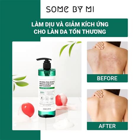 Sữa Tắm Giảm Mụn Some By Mi Aha Bha Pha 30 Days Miracle Acne Clear Body