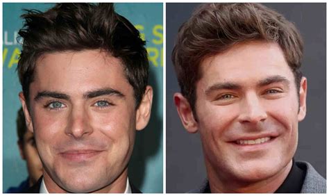 Zac Efron Plastic Surgery Longevita