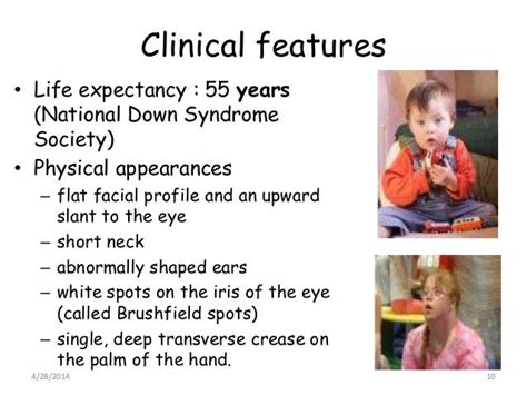 Down Syndrome Ppt For Ugs