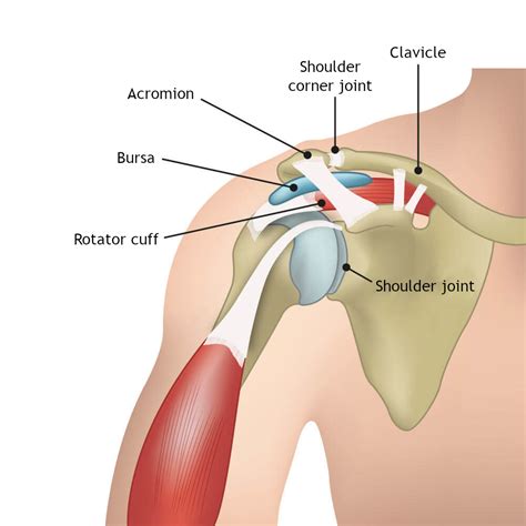 Shoulder Impingement Liebscher Bracht