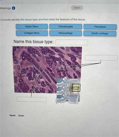 Solved Correctly Identify This Tissue Type And Then Label Chegg