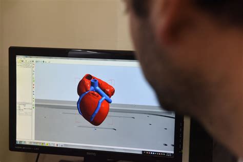 Scientists Print World S First D Heart Using Patient S Own Cells Upi