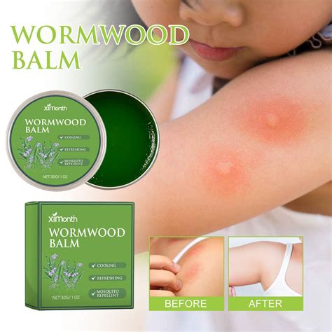 Sfkow Mosquito Bite Itch Relieforganic Afterbite Insect Bite Treatmentanti Itch Creambug Bite