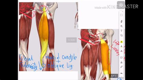 Hamstring Muscles Popliteal Fossa عربي Youtube