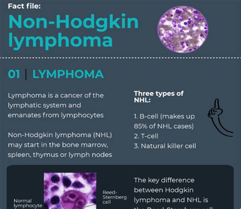 Non-Hodgkin lymphoma: infographic - Oncology Central