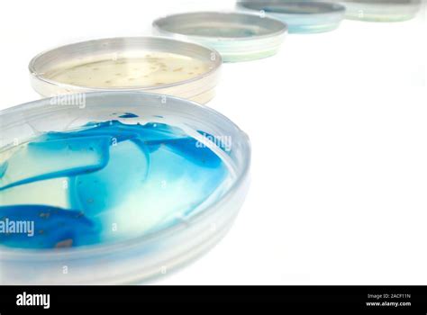 Bacterial Culture Row Of Petri Dishes Containing Bacterial Cultures