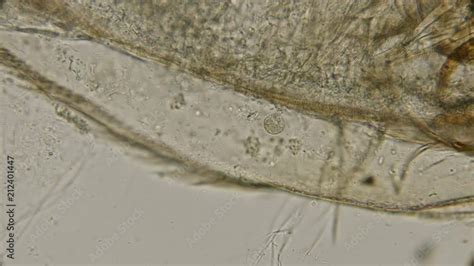 in the body of dead Daphnia parasites formed: Tetrahymena, spirochetes ...