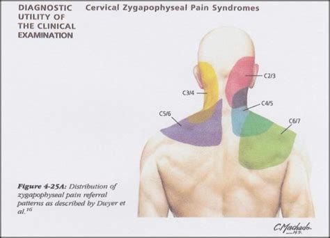 Cervical Dd Cpr Cpg Exam Flashcards Quizlet