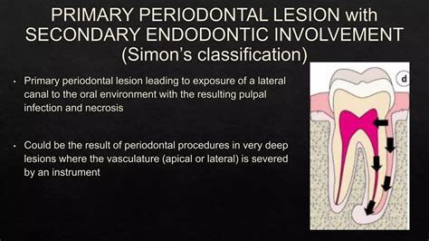 Endo Perio Lesions Ppt