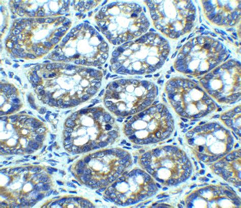 Prosci Autophagy Pathway