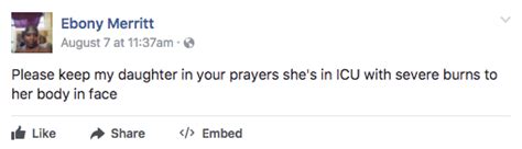 A Mother Is Warning Parents About The Hot Water Challenge After Her Daughter Was Severely Burned