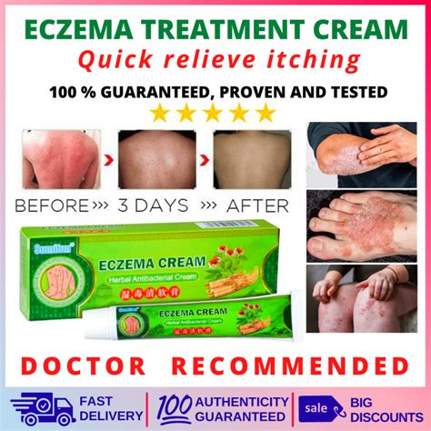 Eczema treatment cream solve skin problems like dermatitis, ringworm ...