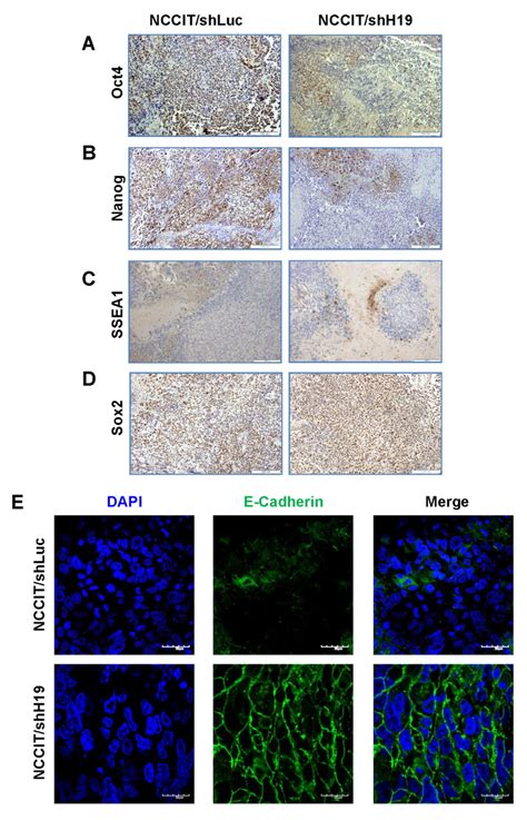 Nccitshh19 Derived Xenografts Show Down Regulation Of Oct4 And Nanog Download Scientific