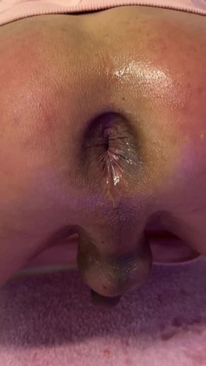 Jaw Dropping Moment From Prank Of Widening The Shemale Whore Ladyboy Ladyboy Porn XHamster