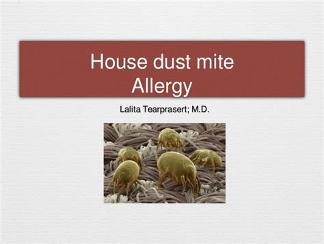 House dust mite allergy