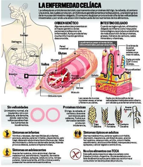 Celiaco Enfermedad Celiaca Salud Salud Y Bienestar