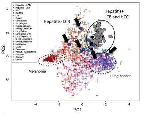 Riken Scientists Use Dna And Rna Sequencing To Connect Hepatitis And Liver Cancer Rna Seq Blog