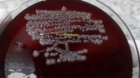 Klebsiella Pneumoniae Introduction Identification Features