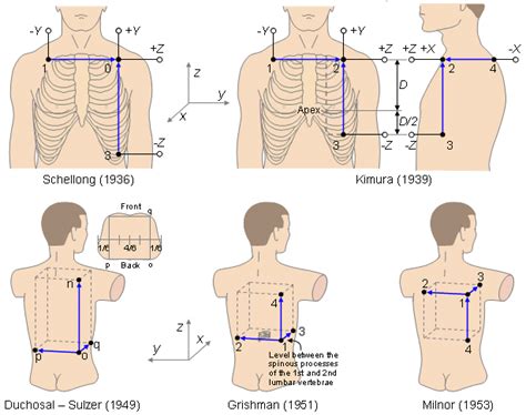 15 lead ecg placement posterior - lineartdrawingsbrowncolor