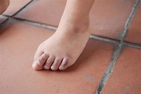 Primer Plano De Los Pies Secos De Un Niño De 5 Años En El Suelo Foto Premium