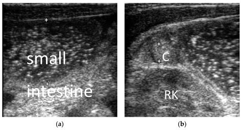 Diagnostics Free Full Text Ultrasonic Diagnosis Of Intestinal