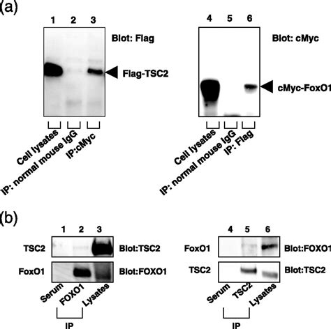 Interaction Of Foxo And Tsc Induces Insulin Resistance Through