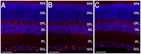 This Figure Shows The Expression Of 15 Lox 1 Gene Transfer In The