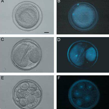 First Polar Body Stage Oocytes From Breeding Age Months Of Age