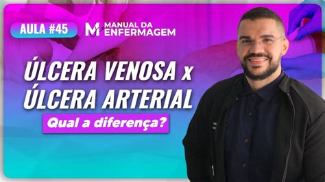 Lcera Venosa X Lcera Arterial Qual A Diferen A Live Youtube