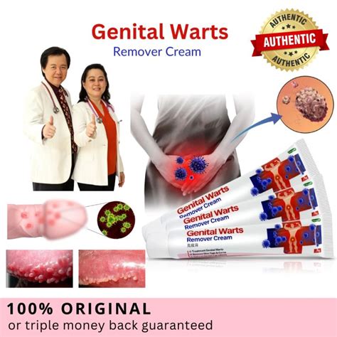 FLASH SALE PROVEN SAFE EFFECTIVE Original Genital Warts Remover