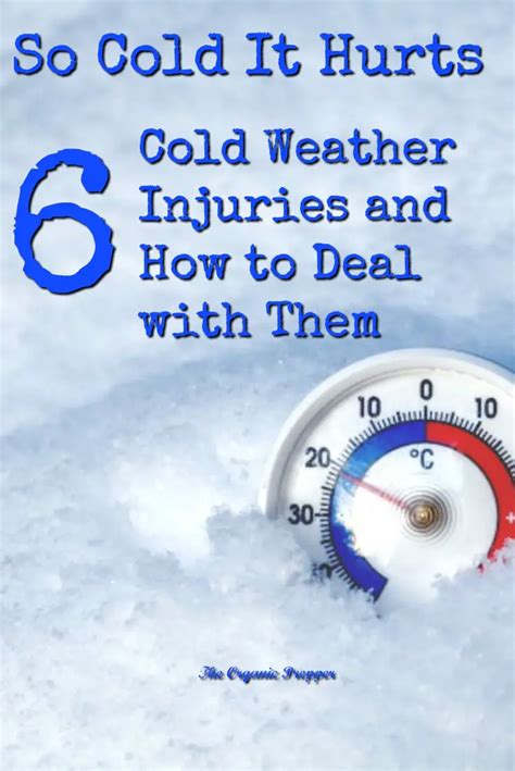 6 Cold Weather Injuries and How to Deal with Them - The Organic Prepper