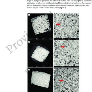 Representative Scanning Electron Microscopy Images Cross Sectional