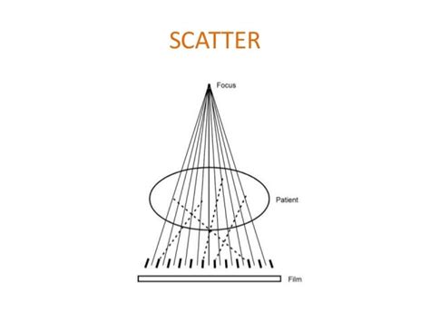 Radiographic Grids