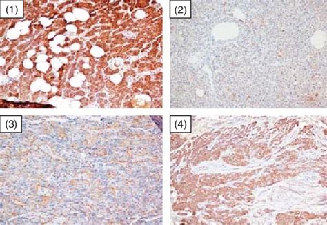 Microphotographs Showing Localization Of Vdr Expression In Tissue