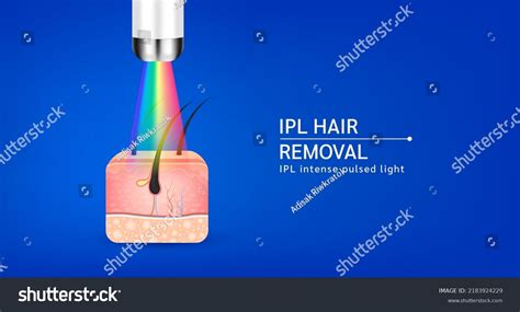 Skin Layers Anatomy Hairs Ipl Light Stock Vector Royalty Free