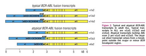 Atypical Bcr Abl Mrna Transcripts In Adult Acute Lymphoblastic Leukemia