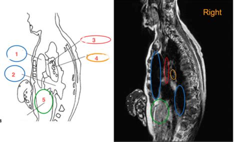 Sectional Anatomy Exam 1 Chapter 5 Flashcards Quizlet