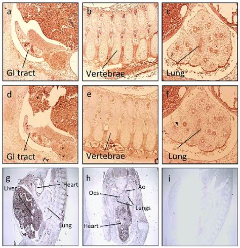 Tissue Expression Of Hoxd And Hoxd In The Developing Fetus