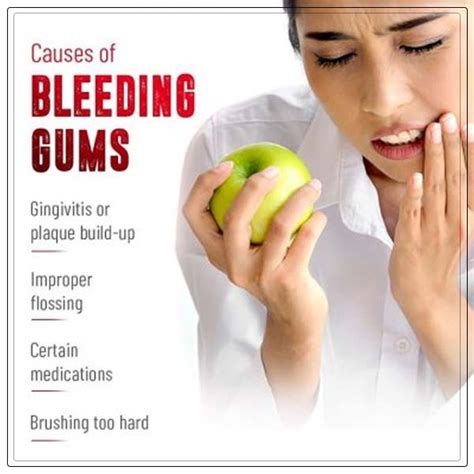 Bleeding Gums Causes - REPC