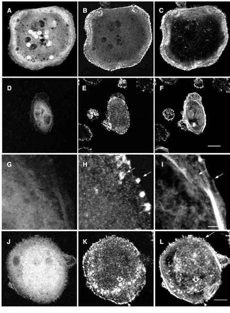 Figure 3 From Rho And Rac Exert Antagonistic Functions On Spreading Of