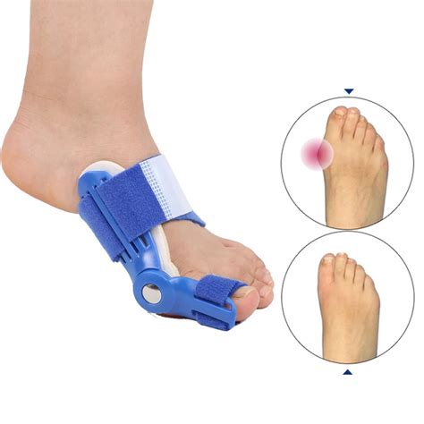 Jual Alat Korektor Jempol Ibu Jari Kaki Alat Terapi Bunion Pelurus