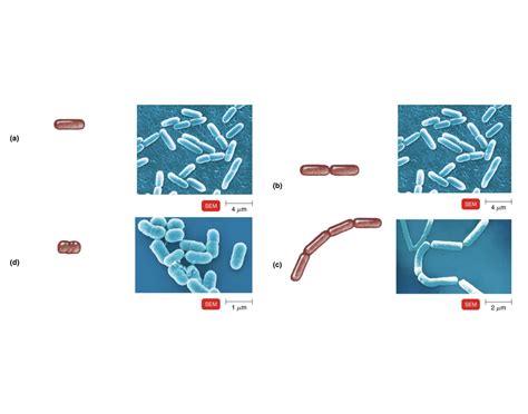 Name these Bacilli Arrangements Quiz