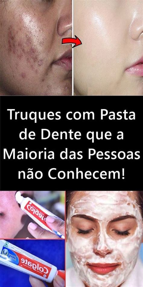 Truques Pasta De Dente Que A Maioria Das Pessoas N O Conhecem