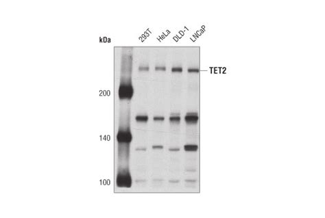 Tet2 Antibody Cell Signaling Technology